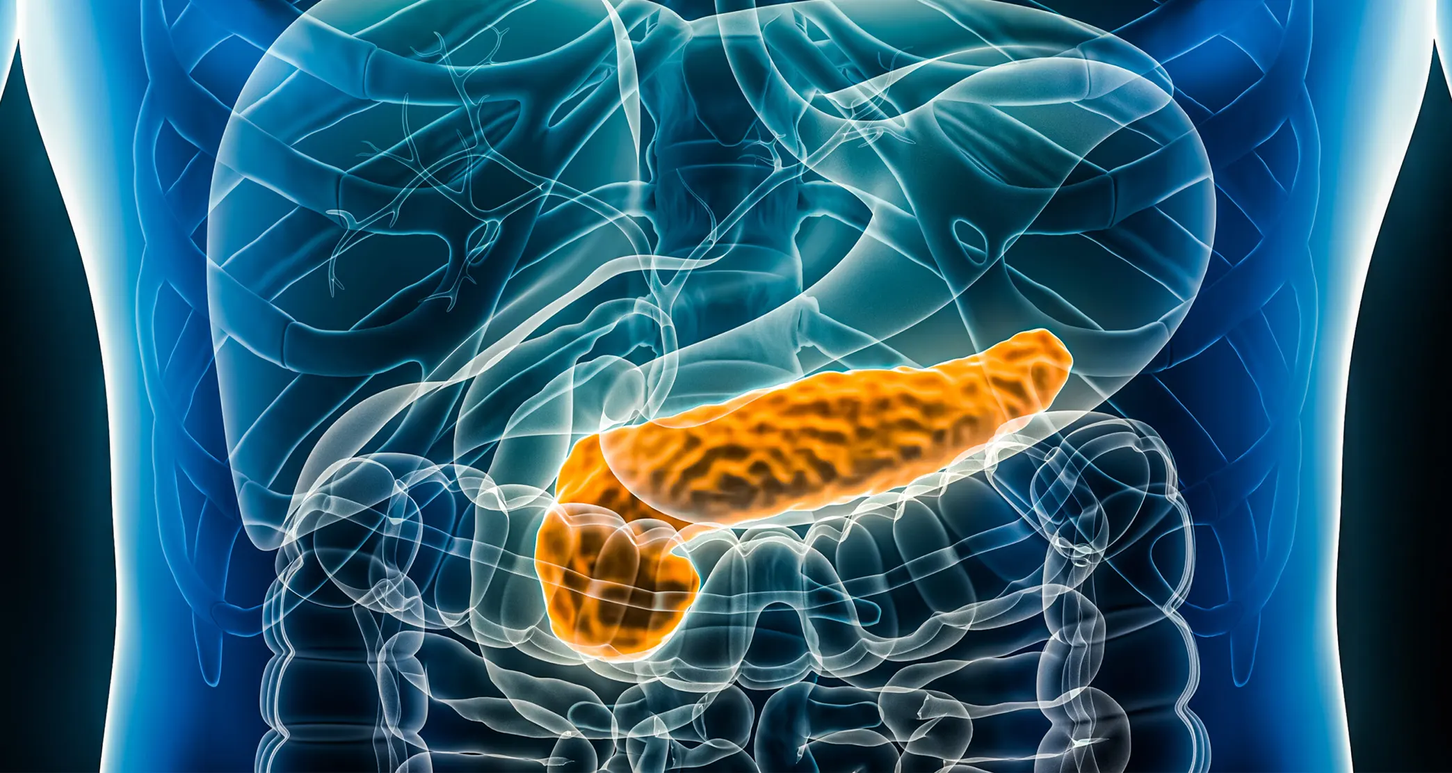 Acute & Chronic Pancreatitis Management