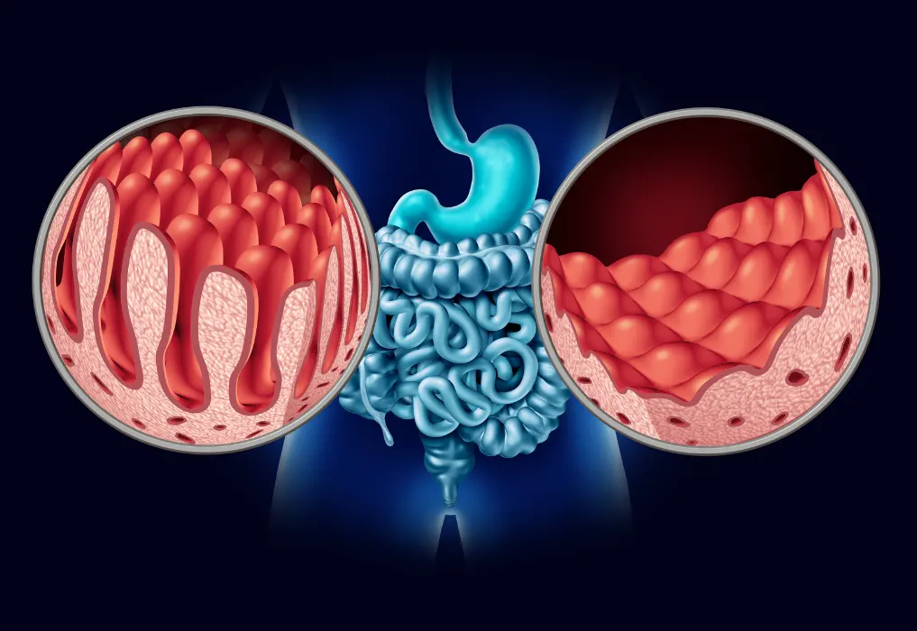 Best Gastroenterologist in Gurgaon